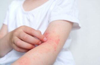 Research Says U.S. Infants Are Lacking a Key Intestine Microbe, Fueling Allergy Danger